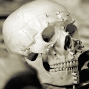 skull_with_markers.jpg